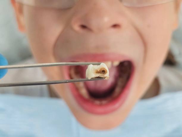 Best Mobile Emergency Dentist in Booker, TX